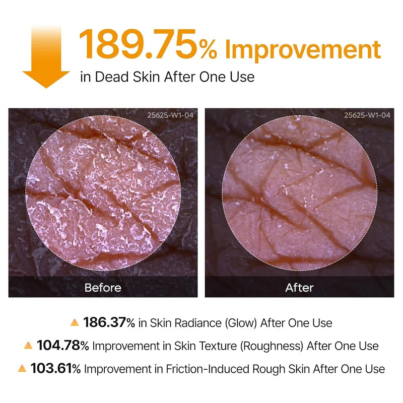 Dr. Melaxin Peel Shot | Kojic Acid Spray for Smoother Skin ✨ د. ميلاكسين بيل شوت | بخاخ حمض الكوجيك لبشرة أكثر نعومة