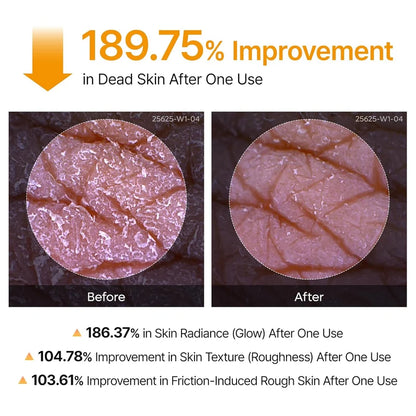 Dr. Melaxin Peel Shot | Kojic Acid Spray for Smoother Skin ✨ د. ميلاكسين بيل شوت | بخاخ حمض الكوجيك لبشرة أكثر نعومة