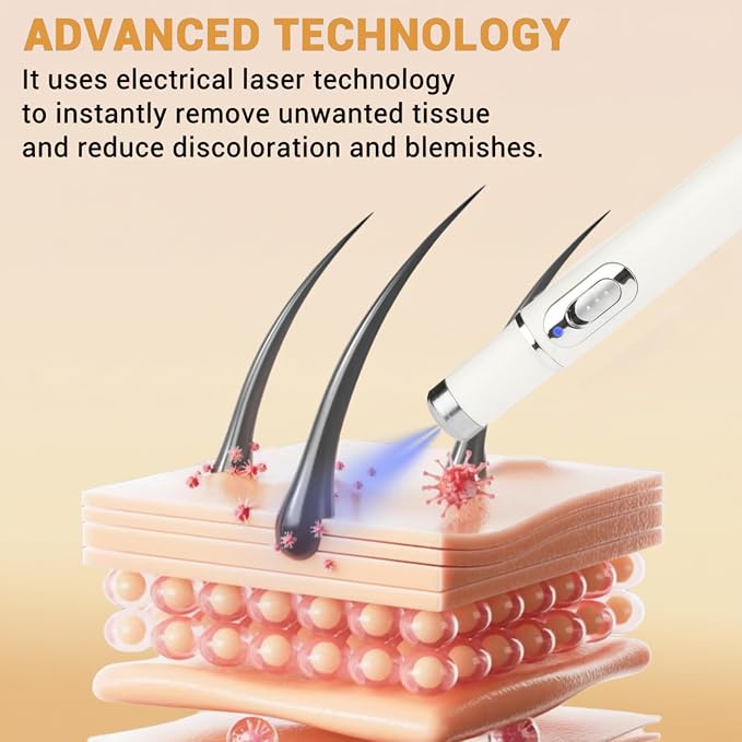 Non-Invasive Mole & Wart Removal Laser Pen قلم الليزر لإزالة الشامات والثآليل