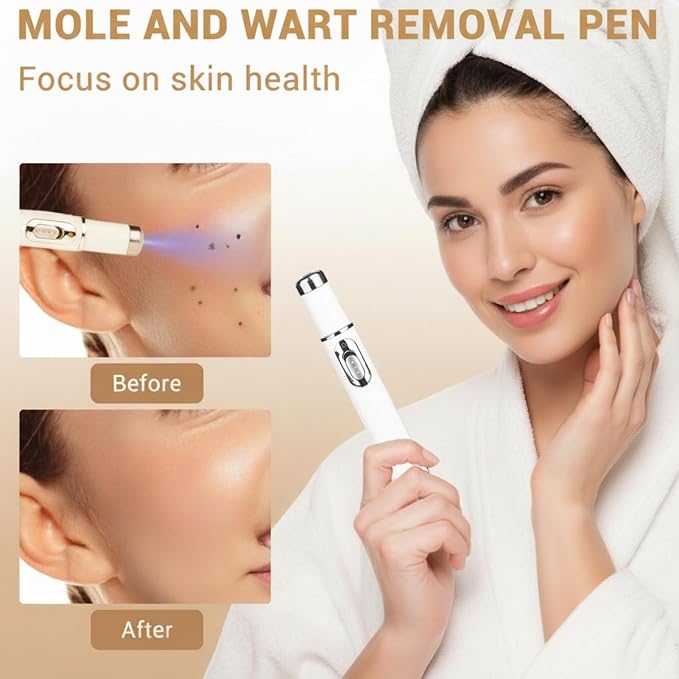 Non-Invasive Mole & Wart Removal Laser Pen قلم الليزر لإزالة الشامات والثآليل