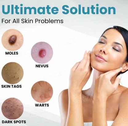 Non-Invasive Mole & Wart Removal Laser Pen قلم الليزر لإزالة الشامات والثآليل