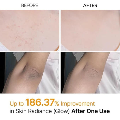 Dr. Melaxin Peel Shot | Kojic Acid Spray for Smoother Skin ✨ د. ميلاكسين بيل شوت | بخاخ حمض الكوجيك لبشرة أكثر نعومة
